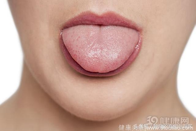 嘴巴里出现4个异常，是舌癌上身了！这次别再认错
