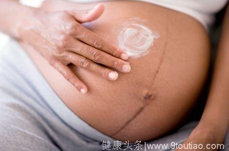 怀孕会不会长妊娠纹，主要看这几个因素，全都不占的恭喜了！