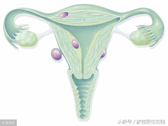 子宫钙化，是子宫癌的前兆？这回医生为大家揭晓正确答案