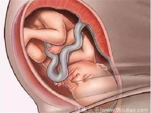 如果孕妈有这5种表现，说明胎儿已经入盆，离出生不远了