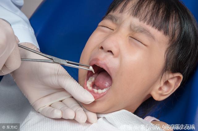 牙科医生告诫所有家长：记住这三点，宝宝换牙不用愁！