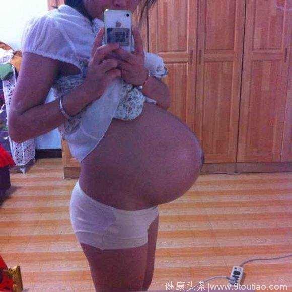 孕妈如果是这种肚型，最好不要顺产，尽量选择剖腹产