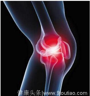 对于膝关节炎我们应该怎么做呢？现在告诉大家，快来看看吧！