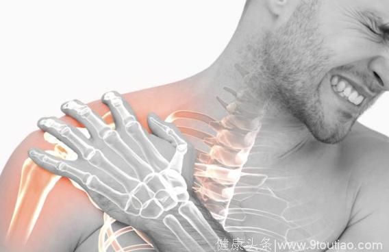 肩周炎还在背锅？10几种疾病都会引发肩关节疼痛，真实案例介绍