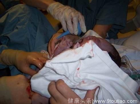 孩子出生5小时后发生“产瘫”左手被废，只怪无知家属这样对孕妇