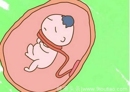 你怀孕的时候胎儿有没有脐带绕颈？防止脐带绕颈这几点要做到