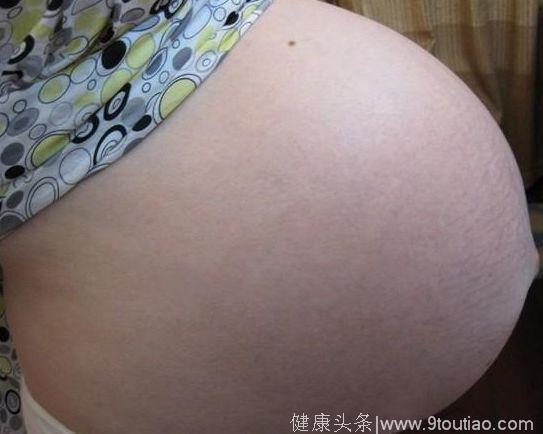 孕妈怀胎10月后产下4条腿的畸形婴儿，这才后悔没早听医生的话