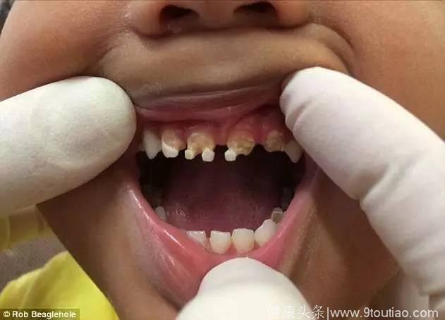 牙医不得不给全部世界的人们看看这些恐怖的照片