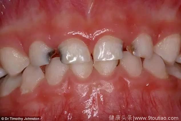 牙医不得不给全部世界的人们看看这些恐怖的照片