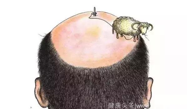 日本的秃顶率有多高？每4个人就有1个面临秃头造成的十万点伤害