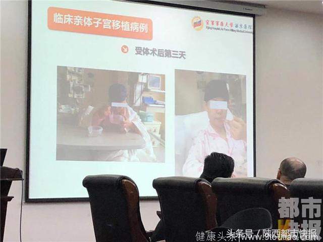 中国第二例人子宫移植手术顺利完成