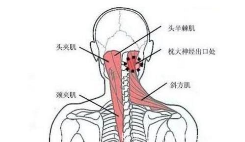 治疗颈椎病：学会斜方肌锻炼，不用再去按摩，最好的医生是自己！