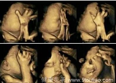 怀孕了还一天一包烟！就来说一说抽烟对胎儿发育的影响