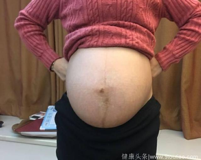 预产期2月17日，2月16日诞下6斤8两小公主一个，孕期症状分享