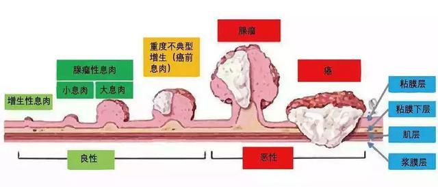 节后体检千万别落下这两项，仅需18元却能救你一命！