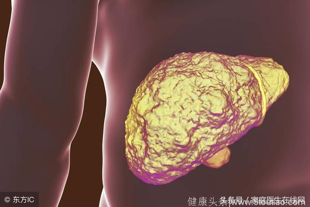 身体有5个典型征兆，暗示肝癌可能已经到来，别轻易忽视