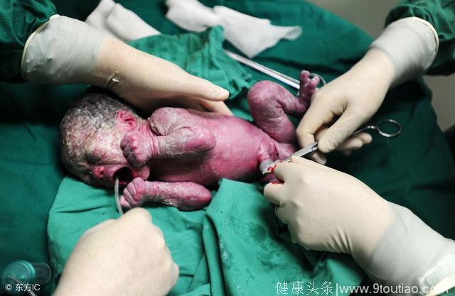 生孩子时，医生把还没出生的孩子塞回孕妈肚内，这又是什么情况？