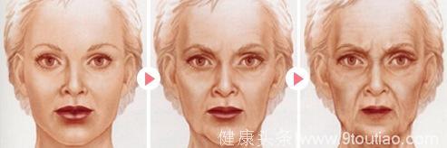 不要让脸上的皱纹暴露了年龄，到了更年期再补胶原蛋白还有用吗？