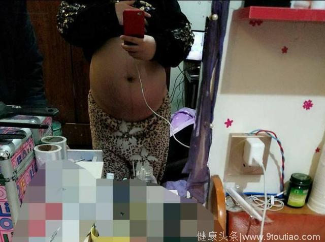 备孕男宝失败，3月1号生下一枚女宝，分享下孕期总结的症状