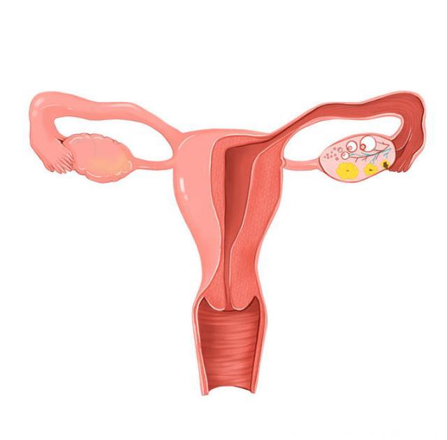 保护卵巢和子宫的措施