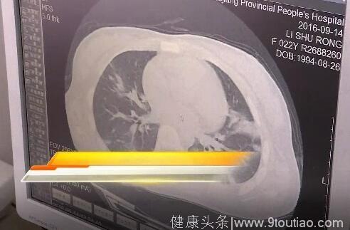 感冒发烧不见好 去医院检查后原因让人想不到