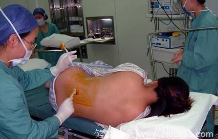 剖腹产真的是无痛分娩吗？剖宫产进行麻醉后产妇还有感觉吗