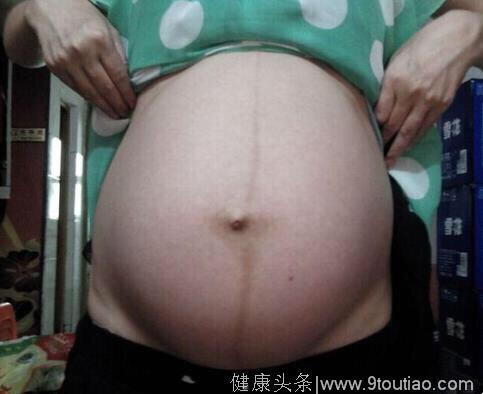 怀孕后，孕妇肚子上的黑线，还有这2个用处