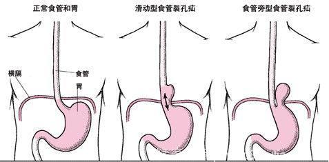 注意！千万别再劝别人“多喝热水”！有可能是在害他