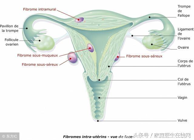 女人想要远离子宫肌瘤，这3件事能做到一件是一件