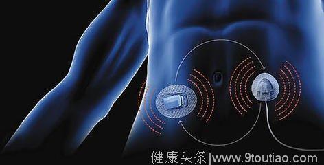 治疗糖尿病新进展：中国科学家取得的新突破