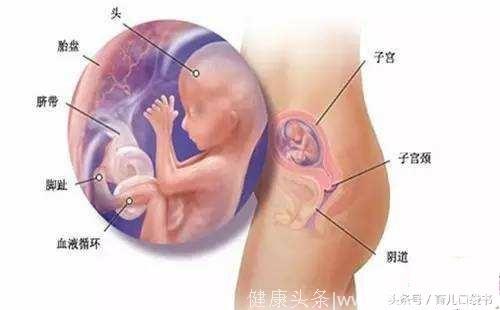 孕期3个习惯，易造成宝宝脐带绕颈，为了避免您剖宫产，一定要改