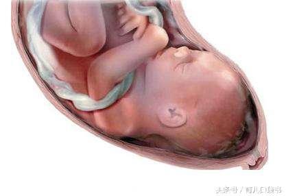 孕期3个习惯，易造成宝宝脐带绕颈，为了避免您剖宫产，一定要改