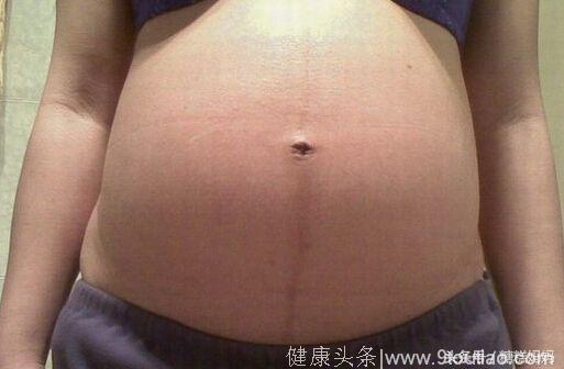 怀孕初期有这些症状，很可能是男宝