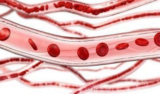 这5行为种让血管提前10年老化，坚持1个习惯血管可焕然如新