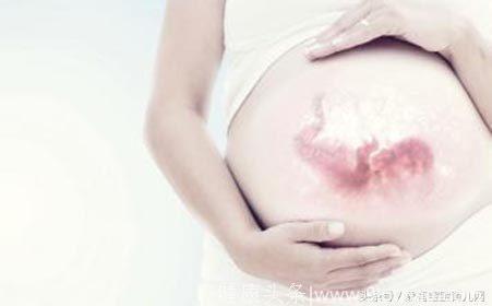 什么是过期妊娠？预产期过了多少天有危险？过期妊娠孕妈该怎么办