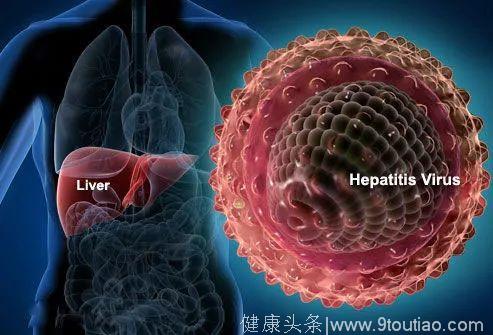 乙肝患者千万不要把停药作为抗病毒治疗的目标！他停药后转肝硬化