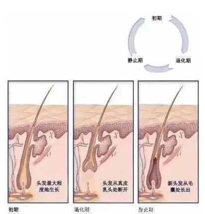 【健康】继脱发后又一难题，白头发究竟能不能拔？看看真相如何？