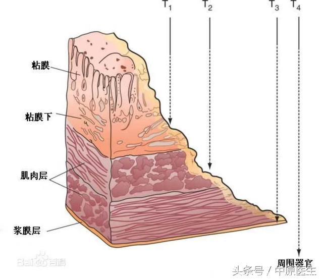 查出癌症，家属犹豫要不要告诉患者，专家却对患者说：恭喜你