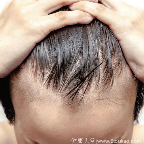 日本体外大规模量产毛囊胚芽成功, 破解“绝顶”之困