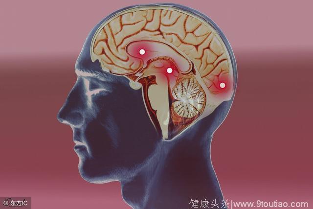 三大诱因导致小脑萎缩，中医针灸如何治疗