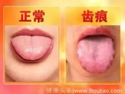 舌头是人体的自查表，出现这7种征兆就要看医生了！