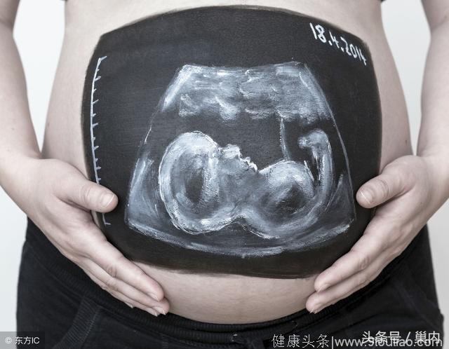 怀孕后一次重要的检查——NT筛查，孕早期别错过