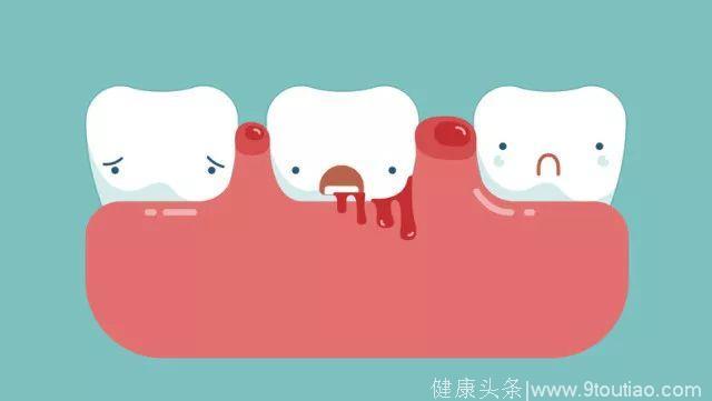 牙龈老出血——难道我得白血病了？！