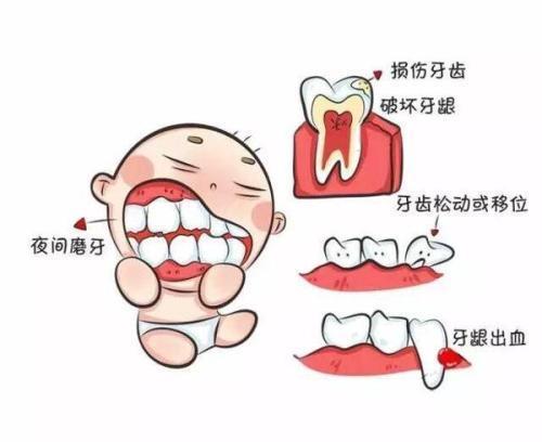 孩子磨牙是身体疾病发出的信号，磨牙家长不可忽视！