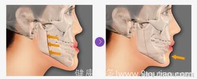 口腔颌面外科-颅颌面创伤和畸形专科