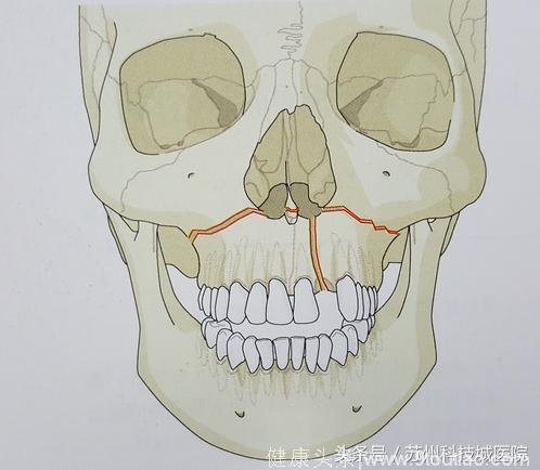 口腔颌面外科-颅颌面创伤和畸形专科