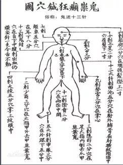 古代中医的不传之秘——专治癫狂、抑郁、精神分裂的鬼门十三针！