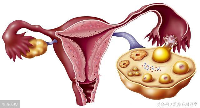 是什么原因导致女性月经前乳腺疼痛