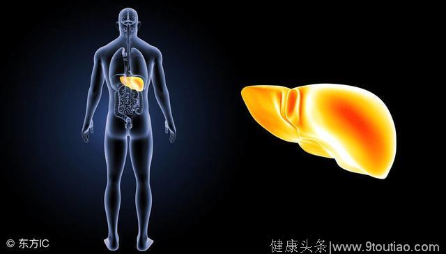 非酒精性脂肪肝可能会演变成肝硬化与肝脏衰竭