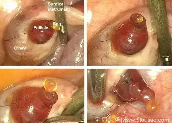 宝宝在妈妈肚子里都在做什么？胎儿子宫内发育全过程，太壮观